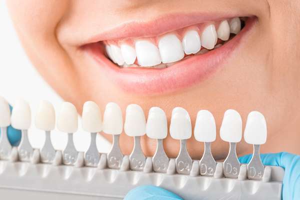 Ask a Cosmetic Dentist: What Are Veneers from McCarthy Dentistry in Marietta, OH
