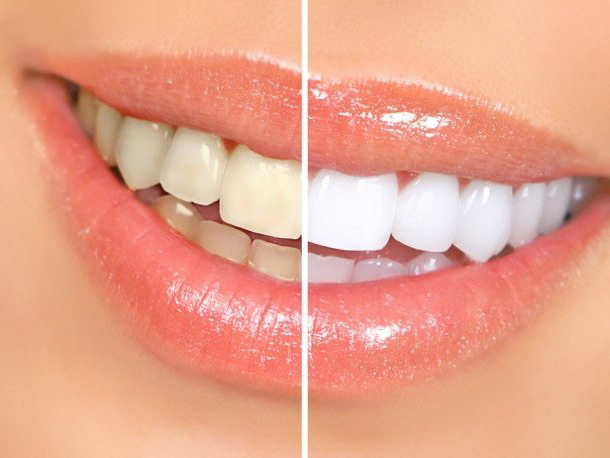 McCarthy Dentistry