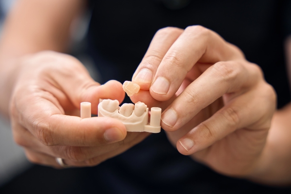 How Dental Crowns Protect Weak Or Damaged Teeth