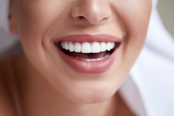 How Long Do Dental Laminates Last?