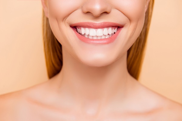 How Are Dental Veneers Made?