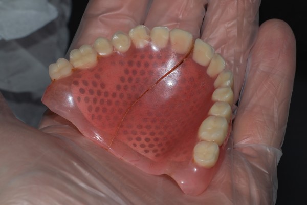 Benefits Of Professional Denture Repair