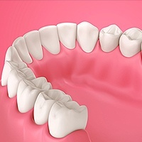 Gum Disease Marietta, OH
