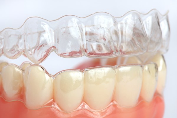 Benefits Of Visiting A Certified Invisalign Dentist Instead Of A General Provider