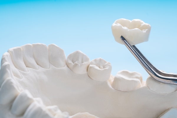 Why You May Need Dental Crowns After A Root Canal