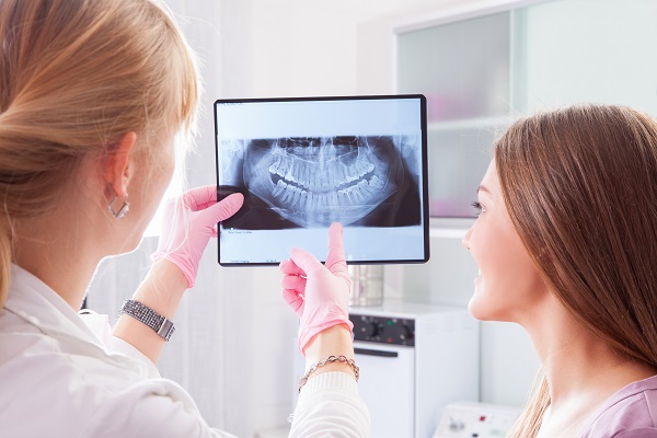 Oral Cancer Screening During Dental Exam