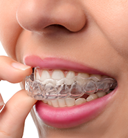 Clear Aligners - Almost Invisible Braces Marietta, OH