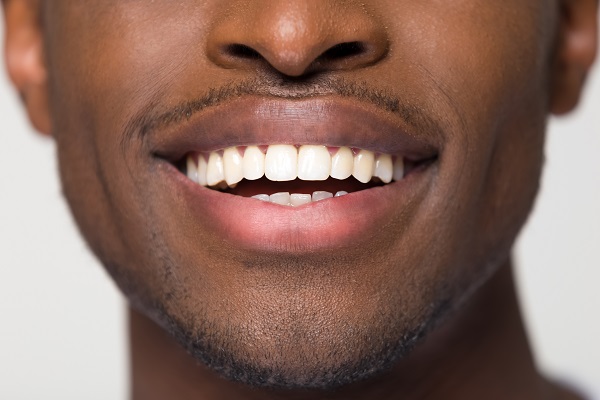 Improve Your Smile With Teeth Straightening Therapy