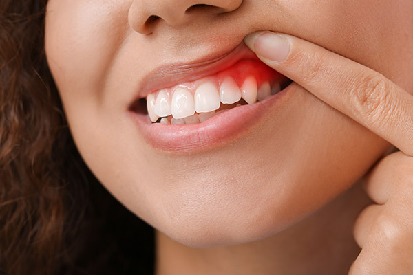 Tips From a Dental Practice on Preventing Gum Disease from McCarthy Dentistry in Marietta, OH