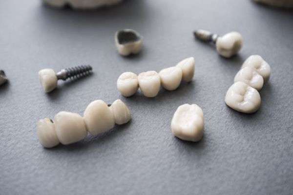 Types of Dental Implants from McCarthy Dentistry in Marietta, OH