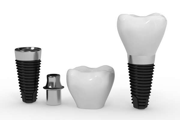 What Are the Parts of Dental Implants from McCarthy Dentistry in Marietta, OH